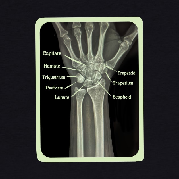 XRAY of Carpal Bones Mixed Media by ckrickett